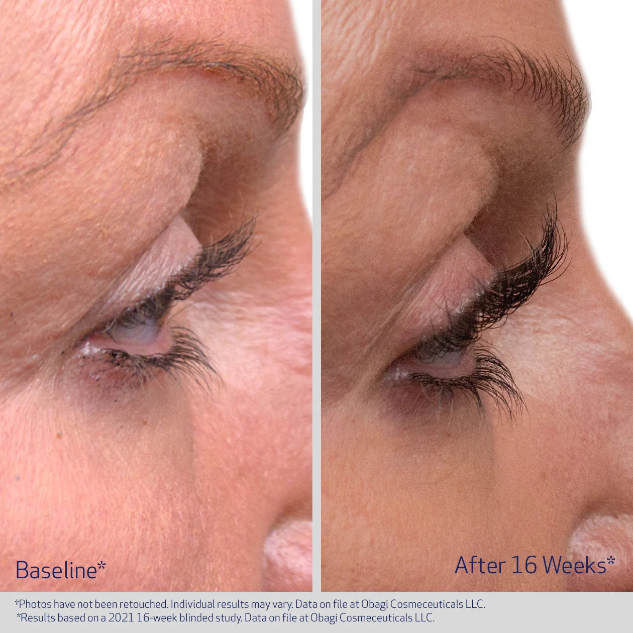 Obagi Nu-Cil® Eyelash Enhancing Serum