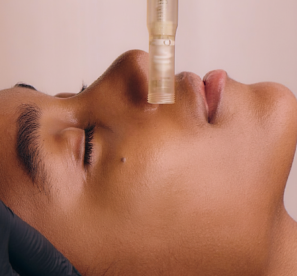 Hydra-Needling by HydraFacial™