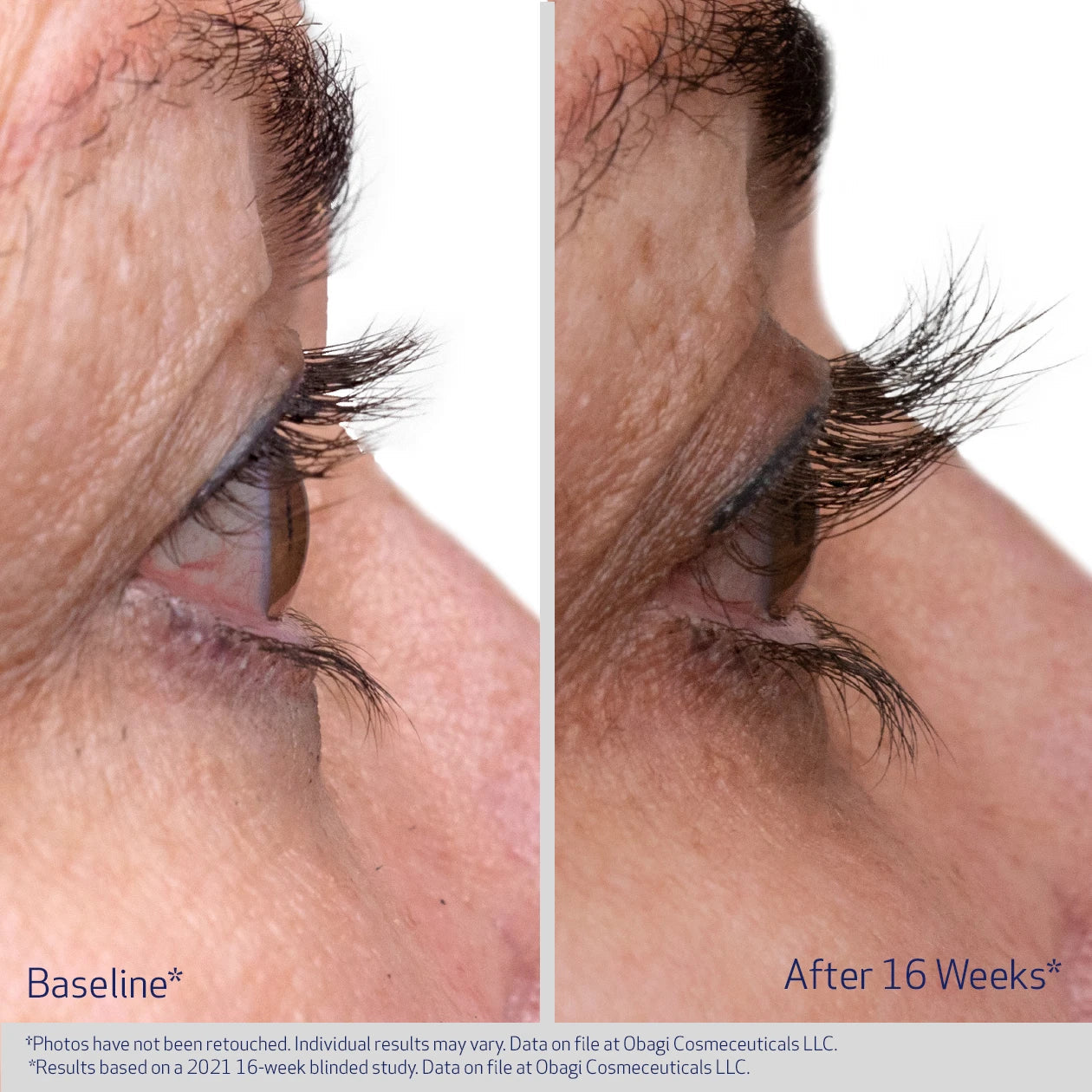 Obagi Nu-Cil® Eyelash Enhancing Serum