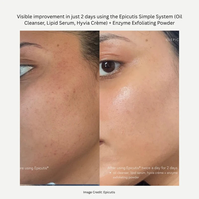 Lipid Serum 1 OZ