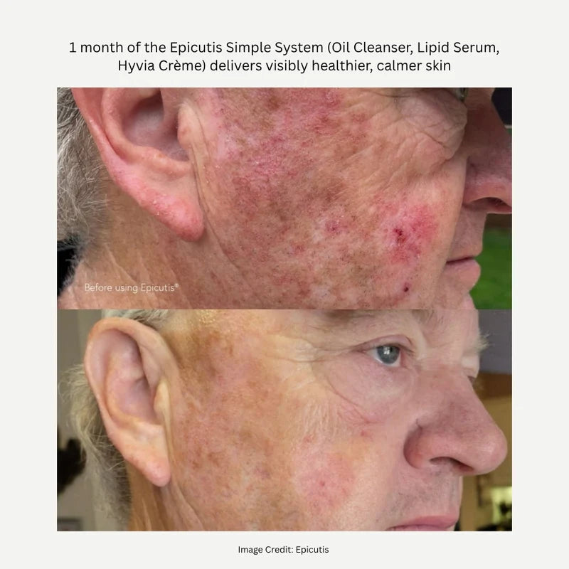 Lipid Serum 1 OZ