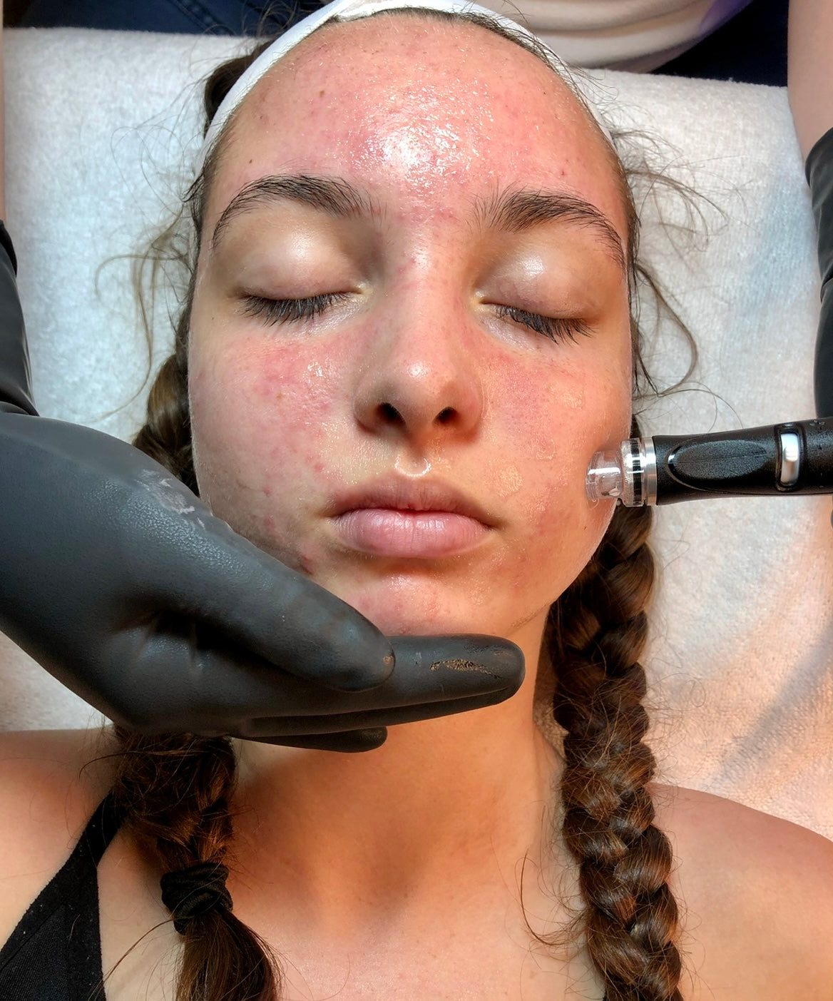 HydraFacial™ Experience