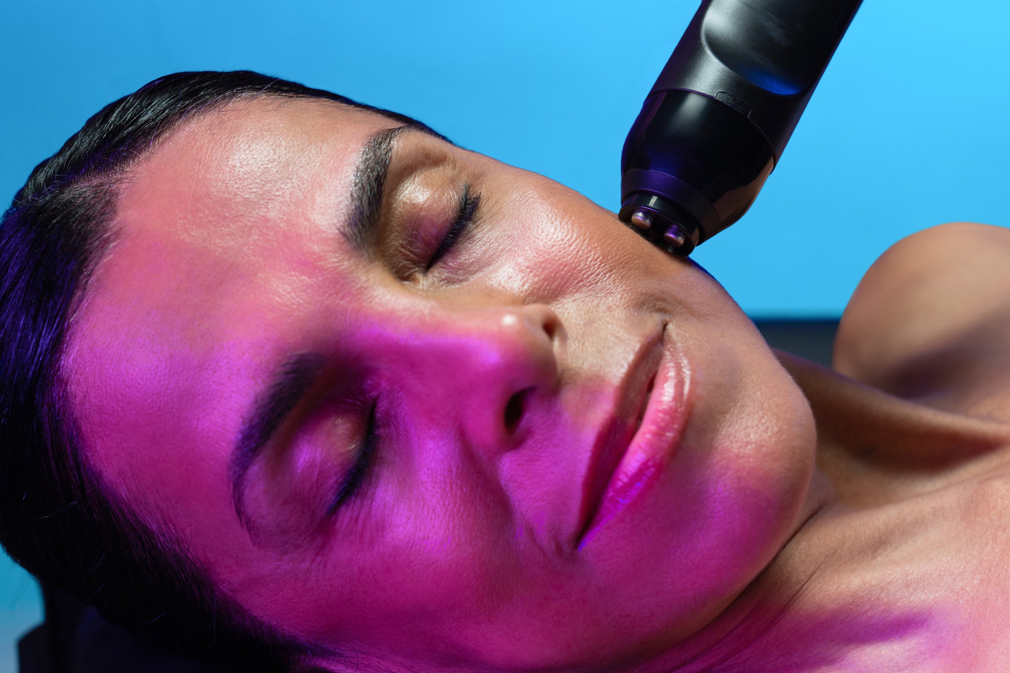 Radio Frequency Sculpting Facial