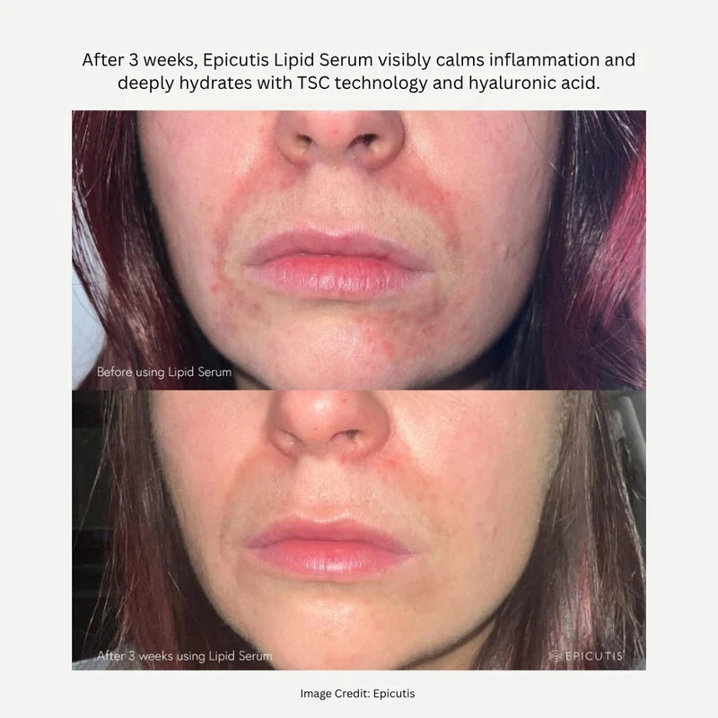 Lipid Serum 1 OZ