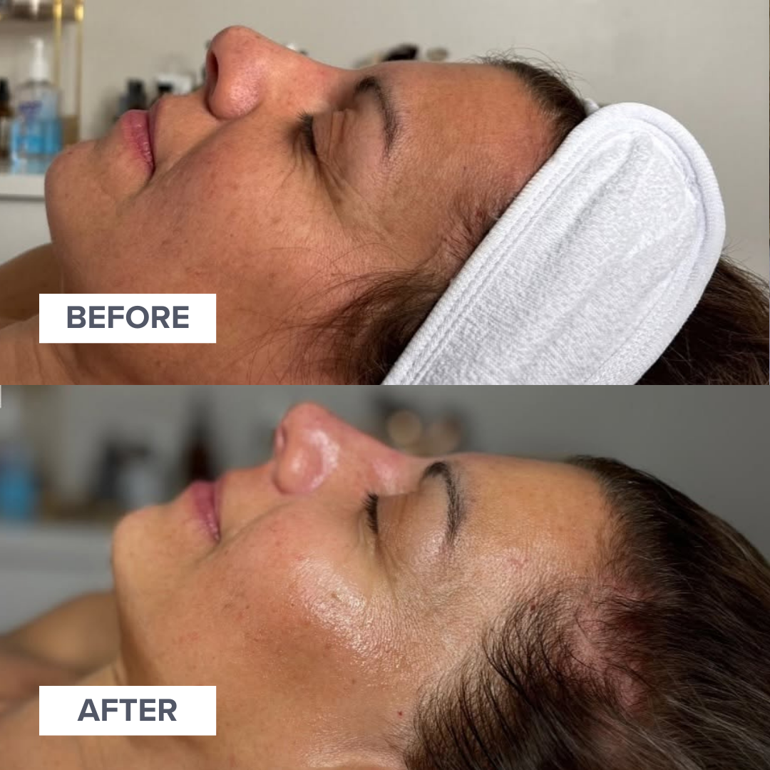 Base Treatment Facials - Spa Treatments | Consultations | All Services – BASE Fashion ...