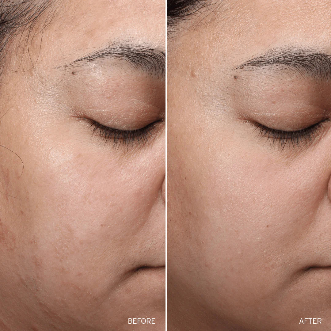 NAD+ Cell Restoration Cream